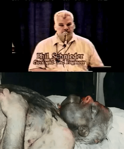 Image: phil-schneider-autopsy-2 (516×621 259 KB)