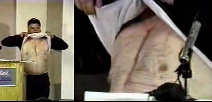 Image: phil-injuries-1 (820×399 24 KB)