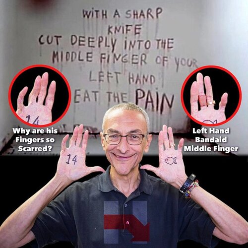 john-podesta-with-fingers-scarring-bandages-and-osiris-numerology-and-symbols